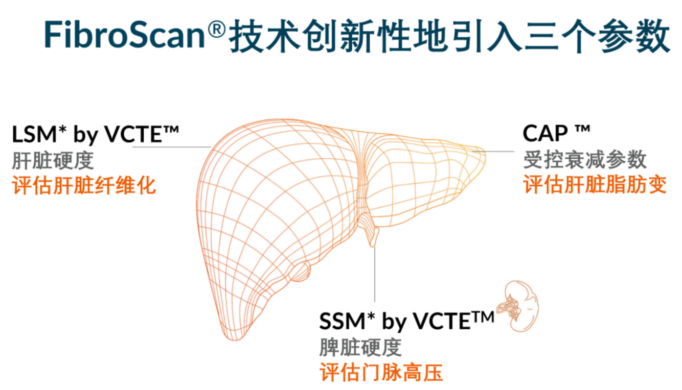 喜訊！FDA擴大了FibroScan?在肝臟綜合管理中的應(yīng)用范圍