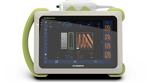 FibroScan HANDY?