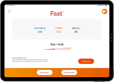 Fast?